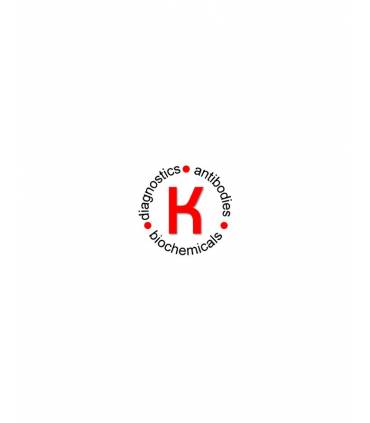 Cluster of differentiation 4, CD4 ELISA Kit, Human