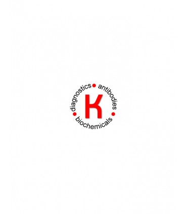 Glucokinase, GCK ELISA Kit, Human