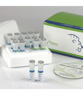 Coronaviru detection kit